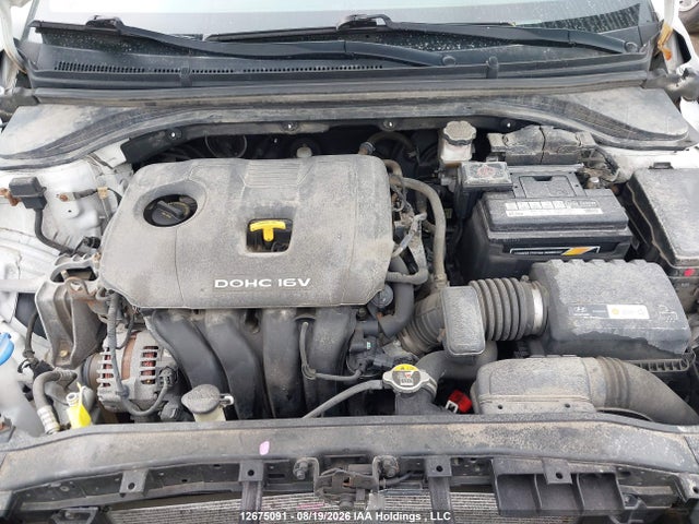 KMHD84LF6JU631150 Hyundai Elantra