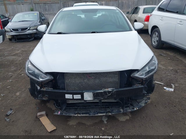 KMHD84LF6JU631150 Hyundai Elantra