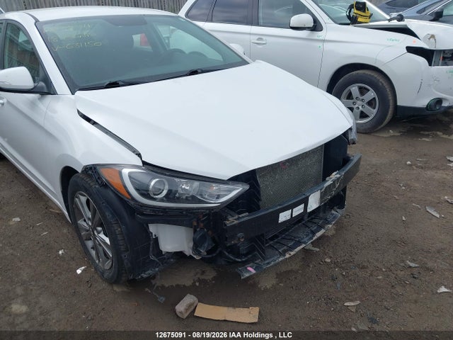 KMHD84LF6JU631150 Hyundai Elantra