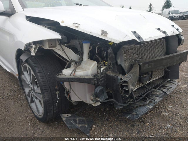 KMHD84LFXJU578565 Hyundai Elantra Sel/value/limited