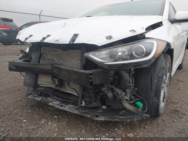 KMHD84LFXJU578565 Hyundai Elantra Sel/value/limited