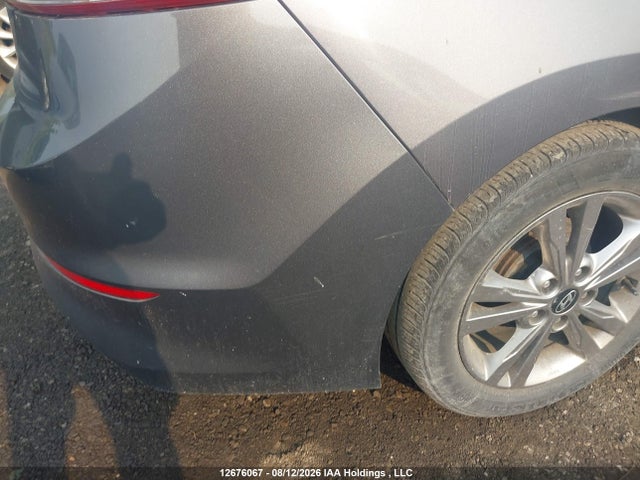 KMHD84LF3HU331611 Hyundai Elantra