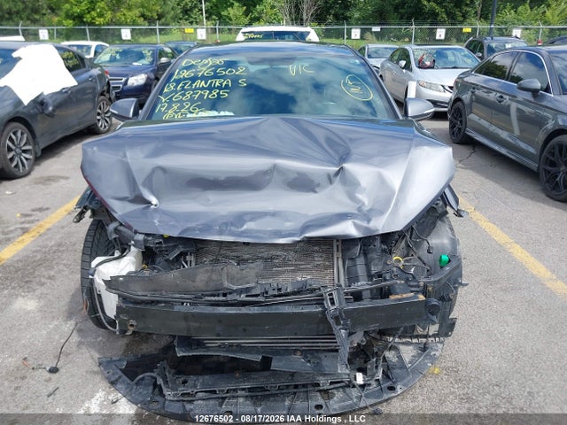 KMHD04LB1JU687985 Hyundai Elantra Sport