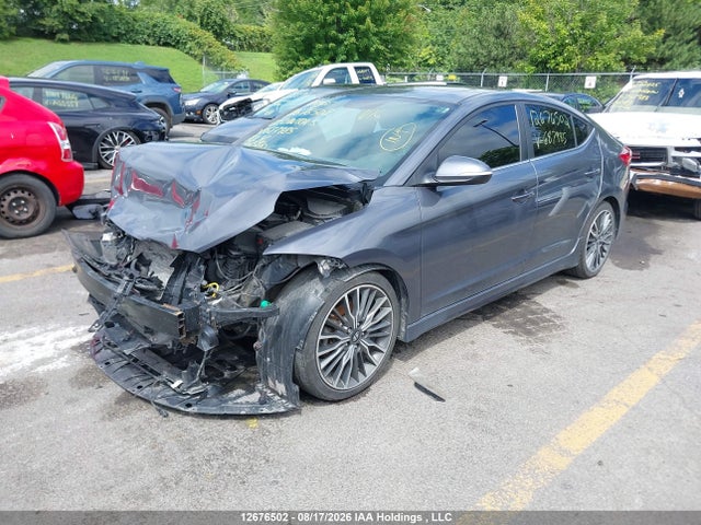 KMHD04LB1JU687985 Hyundai Elantra Sport
