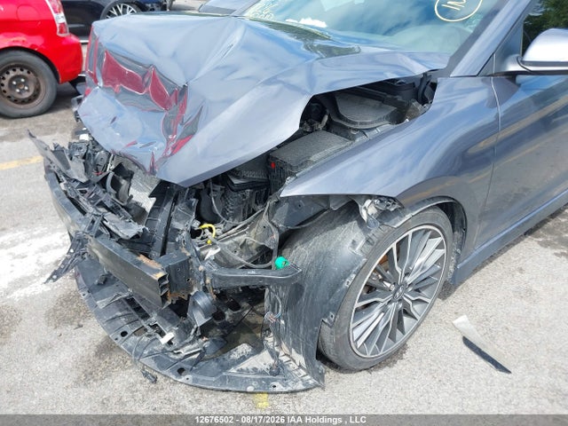 KMHD04LB1JU687985 Hyundai Elantra Sport