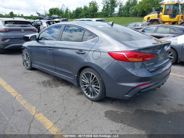 KMHD04LB1JU687985 Hyundai Elantra Sport