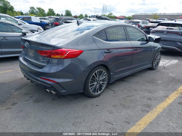 KMHD04LB1JU687985 Hyundai Elantra Sport