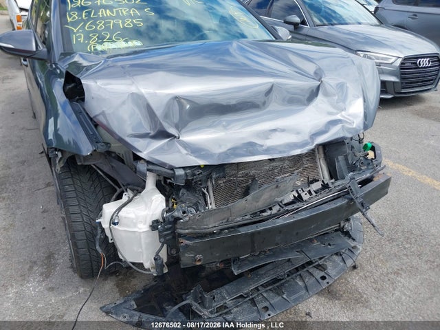 KMHD04LB1JU687985 Hyundai Elantra Sport
