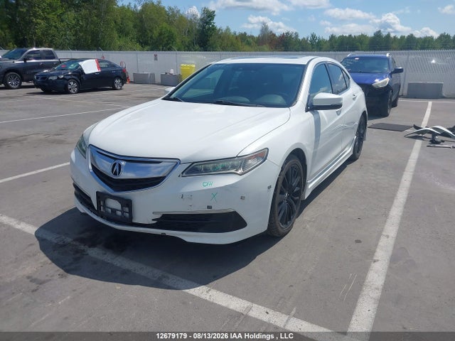 Acura TLX 2015 19UUB3F5XFA801684 Image 2