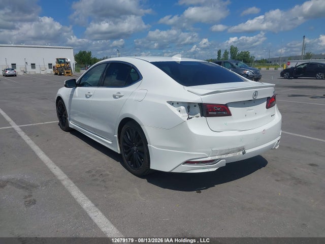 Acura TLX 2015 19UUB3F5XFA801684 Image 3