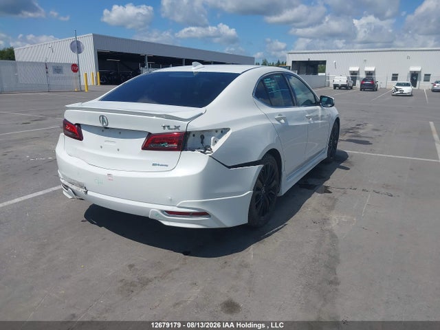 Acura TLX 2015 19UUB3F5XFA801684 Image 4