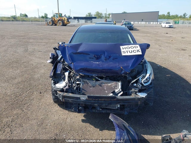 5NPDH4AE4EH517663 Hyundai Elantra