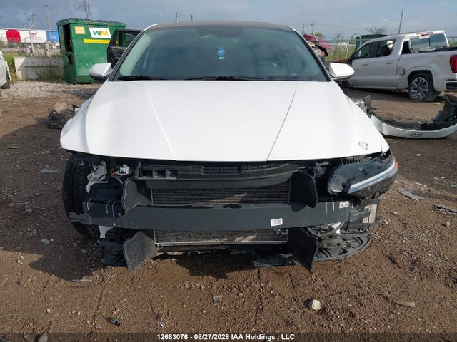 KMHLM4DG1RU670819 Hyundai Elantra
