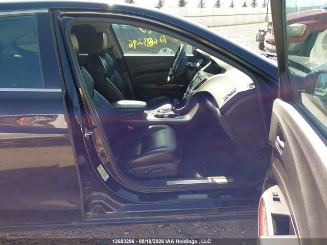 Acura TLX TECH 2015 19UUB1F57FA802070 Image 5