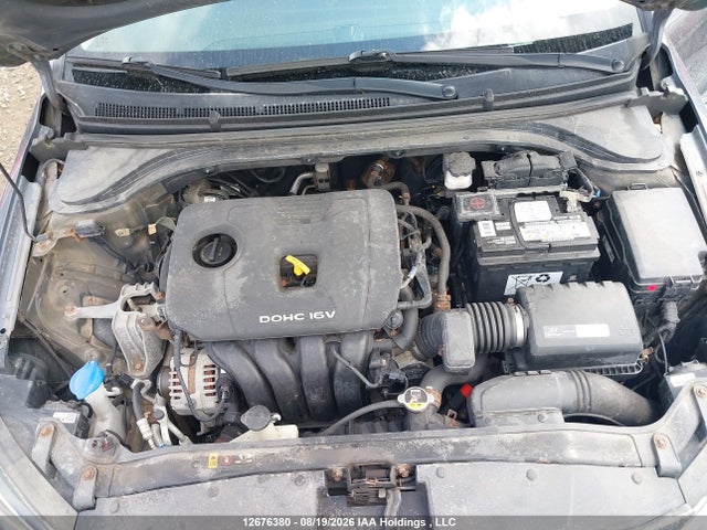 KMHD84LF5JU552567 Hyundai ELANTRA GL