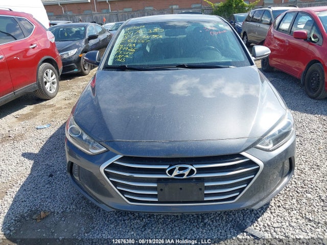 KMHD84LF5JU552567 Hyundai ELANTRA GL