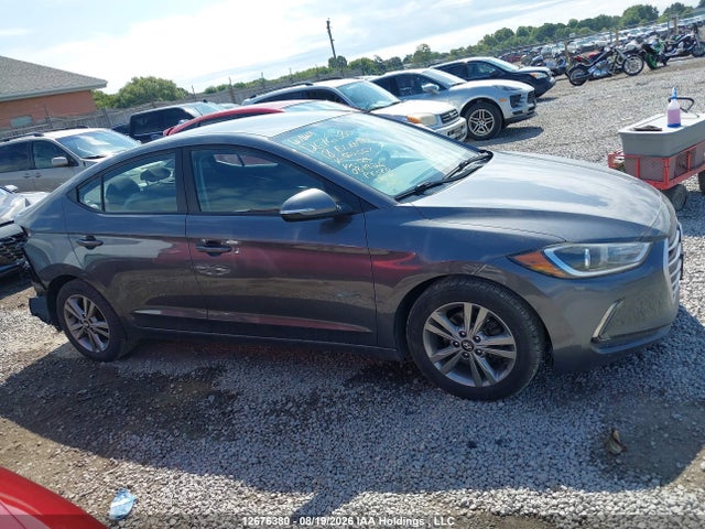 KMHD84LF5JU552567 Hyundai ELANTRA GL