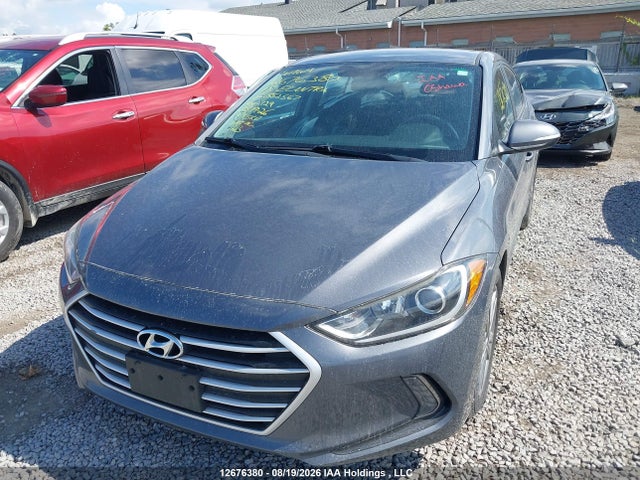 KMHD84LF5JU552567 Hyundai ELANTRA GL