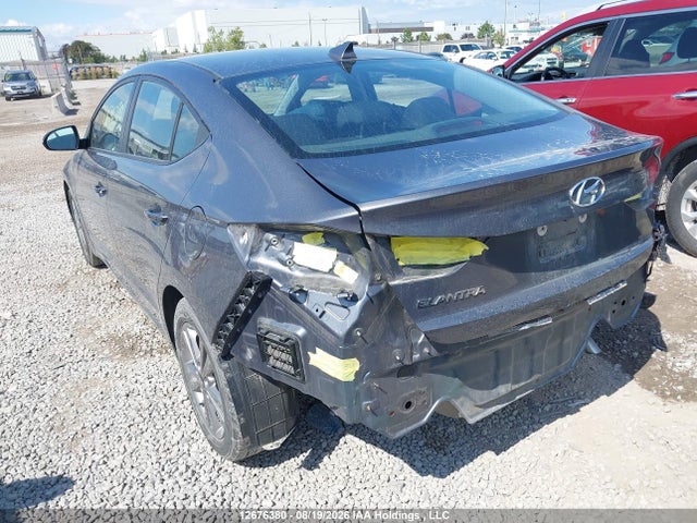 KMHD84LF5JU552567 Hyundai ELANTRA GL