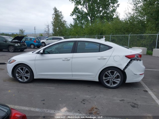 KMHD84LF6HU405362 Hyundai Elantra Gls