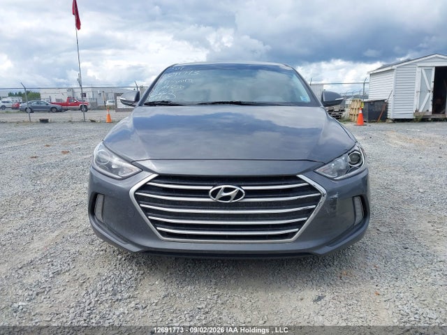 Продаж на аукціоні авто 2017 Hyundai Elantra Gls, vin: KMHD84LF7HU404656, номер лоту: 12691773