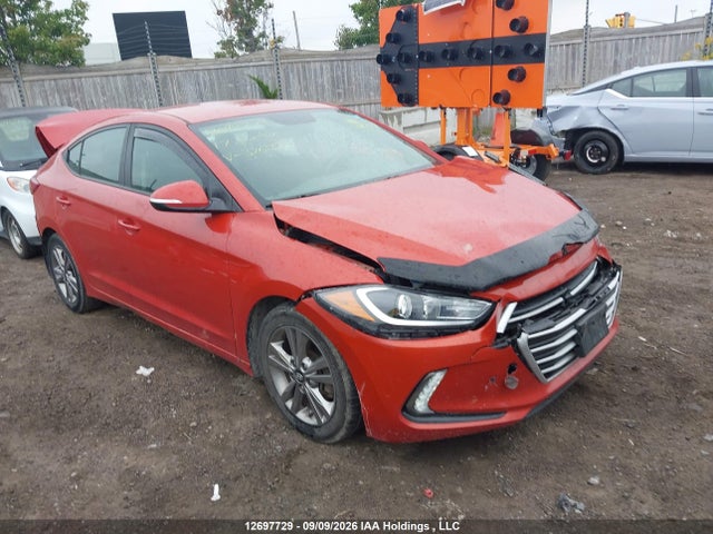 2017 KMHD84LFXHU376139 main image