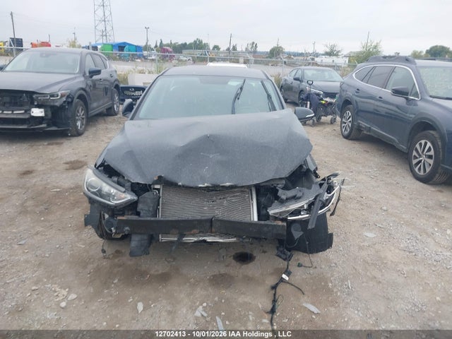 KMHD84LF6HU396467 Hyundai ELANTRA GL