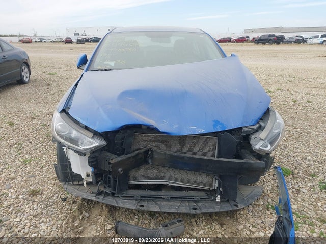 KMHD84LF9JU594594 Hyundai Elantra Sel/value/limited