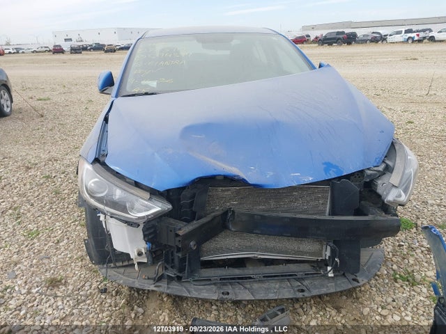 KMHD84LF9JU594594 Hyundai Elantra Sel/value/limited