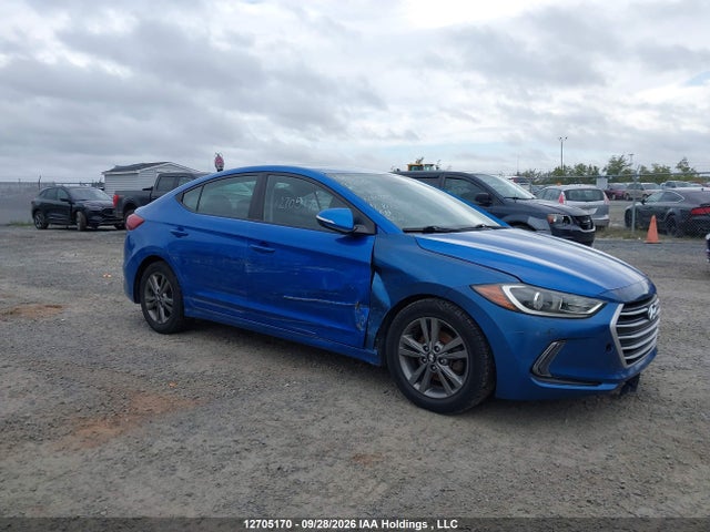 12705170 :رقم المزاد ، KMHD84LF7HU240325 vin ، 2017 Hyundai Elantra Gl مزاد بيع
