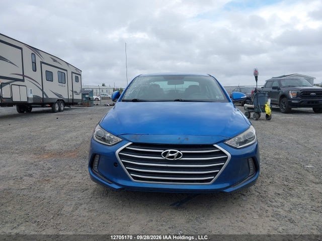 12705170 :رقم المزاد ، KMHD84LF7HU240325 vin ، 2017 Hyundai Elantra Gl مزاد بيع