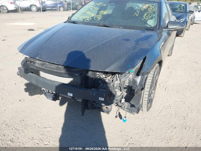 Продажа на аукционе авто 2021 Hyundai Elantra Ultimate Ivt With Tech Package With Two-tone Interior, vin: KMHLN4AG9MU160938, номер лота: 12710191