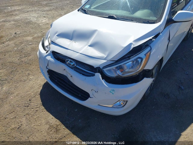 Hyundai ACCENT SE 2017 KMHCT4AE7HU183984 Image 6