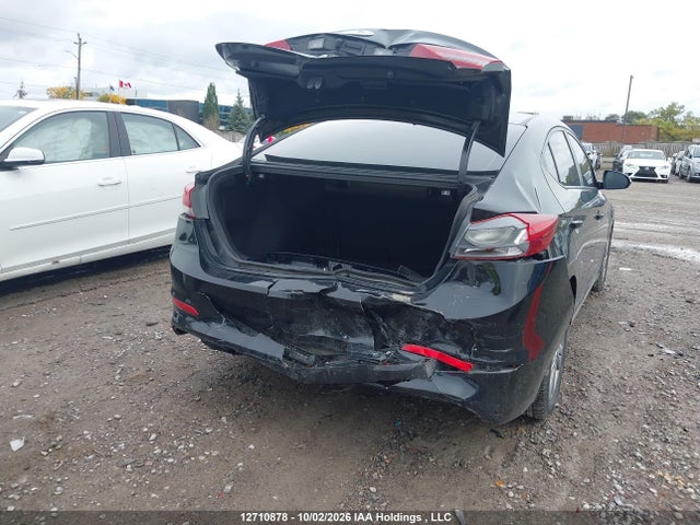 Продаж на аукціоні авто 2017 Hyundai Elantra Se/value/limited, vin: KMHD84LF8HU101823, номер лоту: 12710878