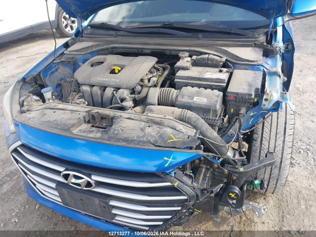 KMHD84LF1HU249716 Hyundai Elantra