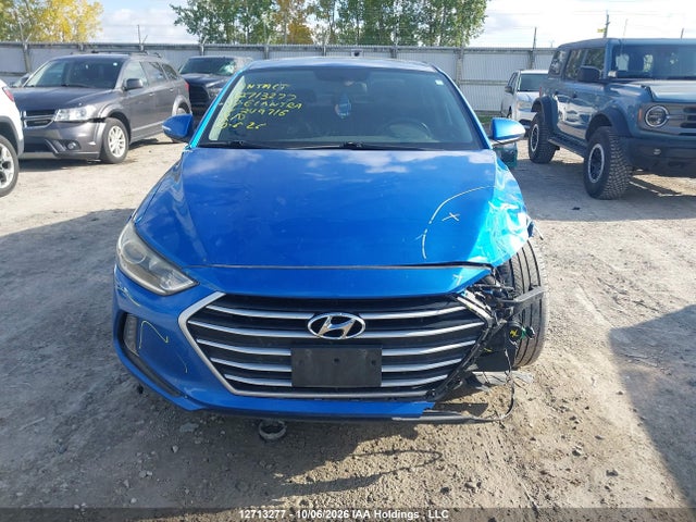 KMHD84LF1HU249716 Hyundai Elantra