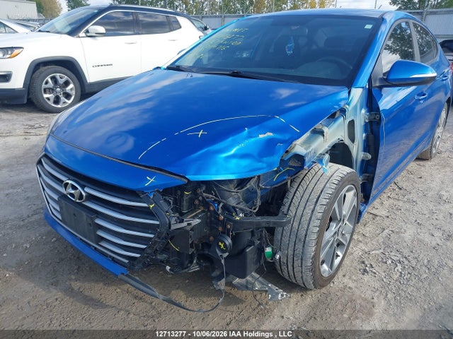 KMHD84LF1HU249716 Hyundai Elantra
