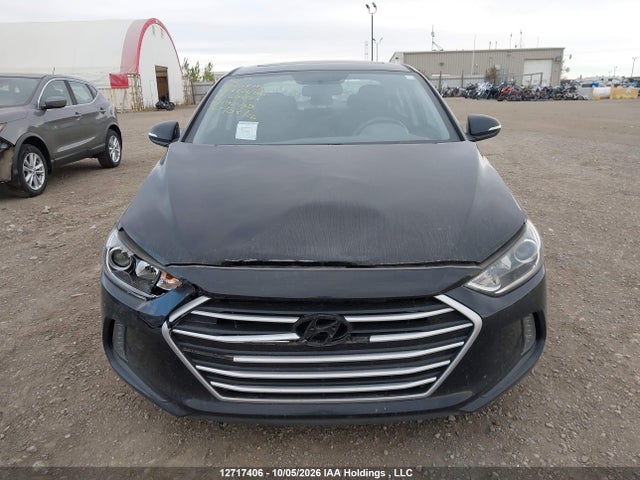 2017 Hyundai Elantra Gls მანქანა იყიდება აუქციონზე, vin: KMHD84LF0HU190450, აუქციონის ნომერი: 12717406