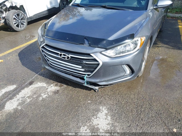 KMHD84LF9JU640389 Hyundai ELANTRA GL