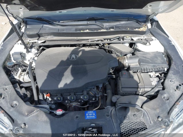 Acura Tlx Advance 2016 19UUB3F77GA802035 Image 10