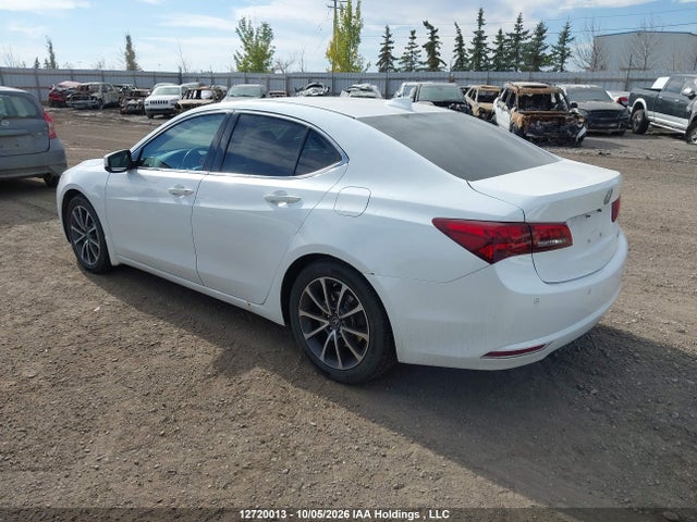 Acura Tlx Advance 2016 19UUB3F77GA802035 Image 3