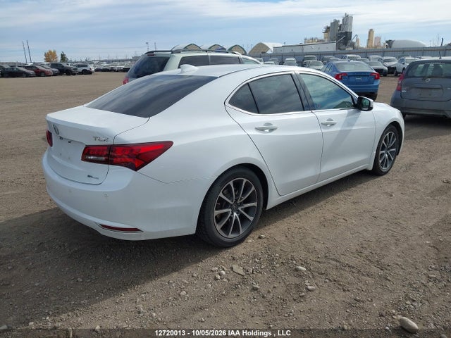 Acura Tlx Advance 2016 19UUB3F77GA802035 Image 4