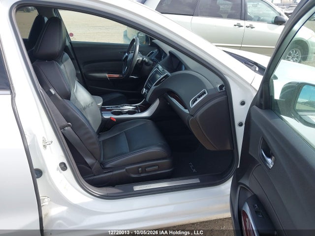 Acura Tlx Advance 2016 19UUB3F77GA802035 Image 5