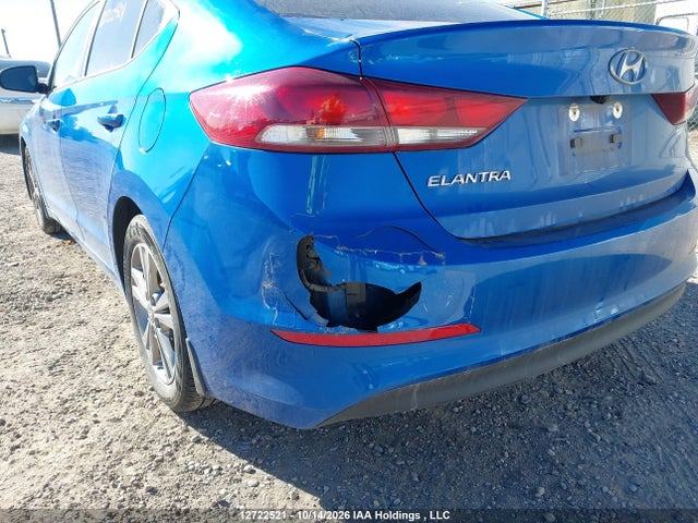 KMHD84LF0JU638529 Hyundai Elantra Sel/value/limited