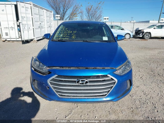 KMHD84LF0JU638529 Hyundai Elantra Sel/value/limited