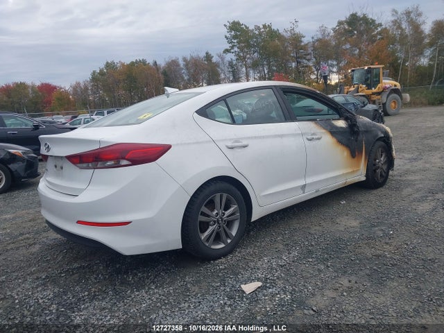 KMHD84LF2JU642386 Hyundai Elantra Sel/value/limited