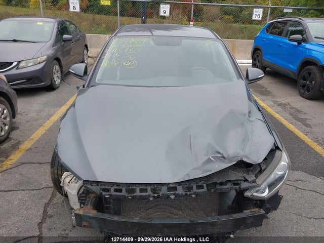 KMHD84LF1JU715750 Hyundai ELANTRA GL