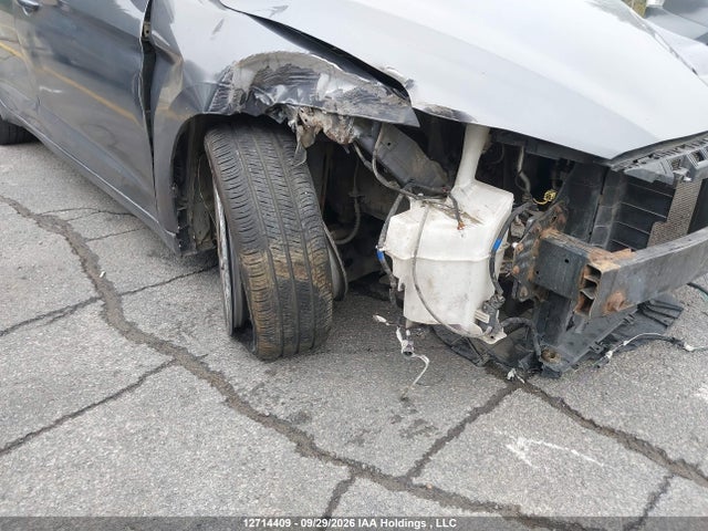 KMHD84LF1JU715750 Hyundai ELANTRA GL