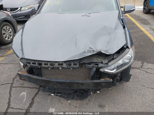 KMHD84LF1JU715750 Hyundai ELANTRA GL