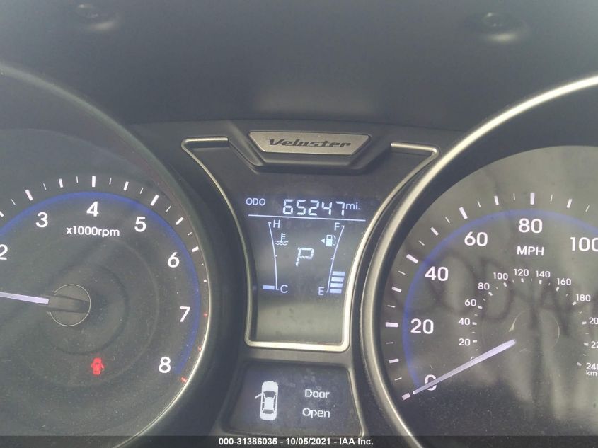 2015 HYUNDAI VELOSTER TURBO KMHTC6AE9FU229243